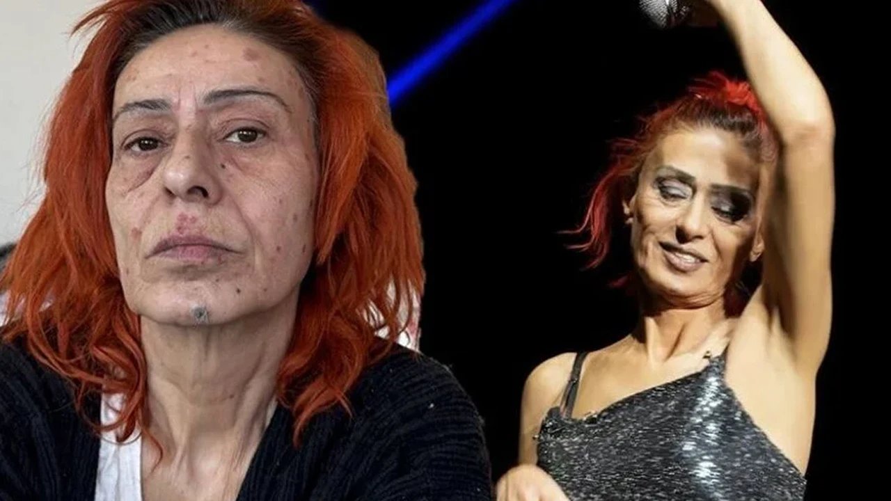 Yıldız Tilbe'nin yüzünde yanıklar oluşmuştu; Olayın perde arkasını anlattı 10 500108