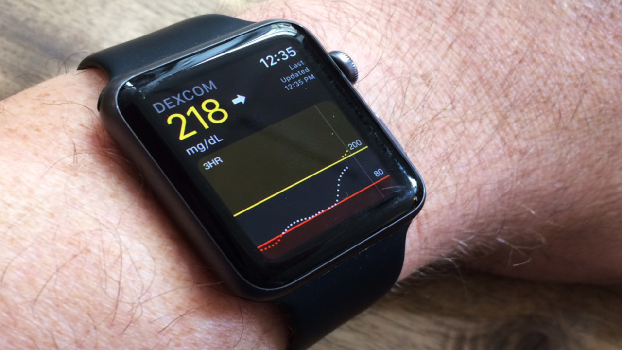 apple watch saglik ozelliklerinin guvenilirligi arastirildi